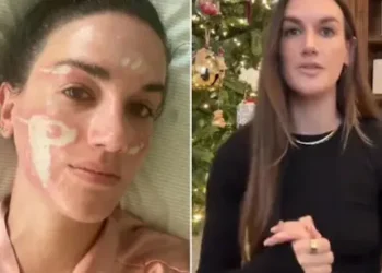 Celebrity Esthetician Lawsuit Raises Alarming Questions About Cosmetic Treatment Safety